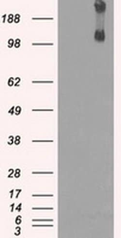Invitrogen JMJD2C Monoclonal Antibody (OTI5B9) 100 &mu;L; Unconjugated:Antibodies,