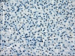 Invitrogen PP5 Monoclonal Antibody (OTI2E12) 100 &mu;L; Unconjugated:Antibodies,