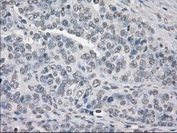 Invitrogen PP5 Monoclonal Antibody (OTI4G8) 100 μL; Unconjugated:Antibodies,