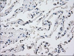 Invitrogen PP5 Monoclonal Antibody (OTI4G8) 100 μL; Unconjugated:Antibodies,
