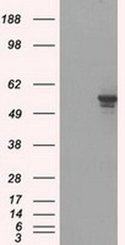 Invitrogen PP5 Monoclonal Antibody (OTI4G8) 100 μL; Unconjugated:Antibodies,