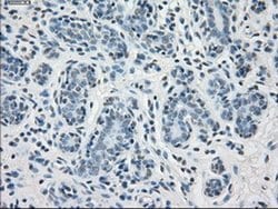 Invitrogen PP5 Monoclonal Antibody (OTI5G5) 100 &mu;L; Unconjugated:Antibodies,