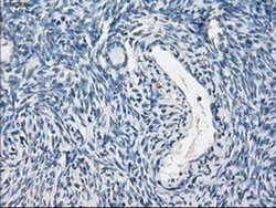 Invitrogen PP5 Monoclonal Antibody (OTI5G5) 100 &mu;L; Unconjugated:Antibodies,