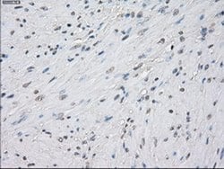 Invitrogen PP5 Monoclonal Antibody (OTI5G5) 100 &mu;L; Unconjugated:Antibodies,