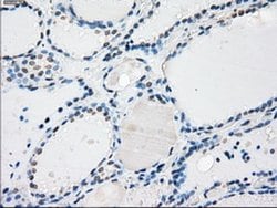 Invitrogen PP5 Monoclonal Antibody (OTI5G5) 100 &mu;L; Unconjugated:Antibodies,
