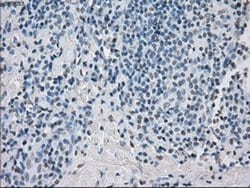 Invitrogen PP5 Monoclonal Antibody (OTI5G5) 100 &mu;L; Unconjugated:Antibodies,