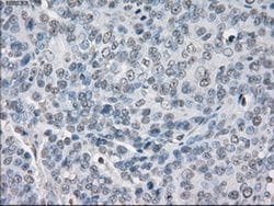 Invitrogen PP5 Monoclonal Antibody (OTI5G5) 100 &mu;L; Unconjugated:Antibodies,