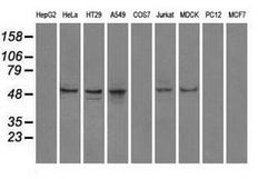 Invitrogen PP5 Monoclonal Antibody (OTI5G5) 100 &mu;L; Unconjugated:Antibodies,