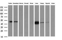 Invitrogen IDH1 Monoclonal Antibody (OTI2H9) 100 &mu;L; Unconjugated:Antibodies,