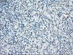 Invitrogen Cytochrome P450 Reductase Monoclonal Antibody (OTI5B3) 100 &mu;L | Buy Online | Invitrogen&trade; | Fisher Scientific
