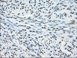 Invitrogen Cytochrome P450 Reductase Monoclonal Antibody (OTI5B3) 100 &mu;L | Buy Online | Invitrogen&trade; | Fisher Scientific