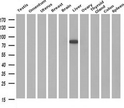 Invitrogen Cytochrome P450 Reductase Monoclonal Antibody (OTI5B3) 100 &mu;L | Buy Online | Invitrogen&trade; | Fisher Scientific