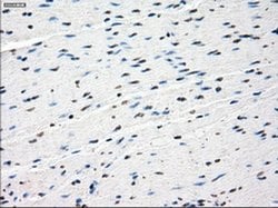 Invitrogen SSX2 Monoclonal Antibody (OTI4A11) 100 &mu;L | Buy Online | Invitrogen&trade; | Fisher Scientific