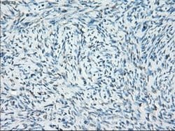 Invitrogen SSX2 Monoclonal Antibody (OTI4A11) 100 &mu;L | Buy Online | Invitrogen&trade; | Fisher Scientific