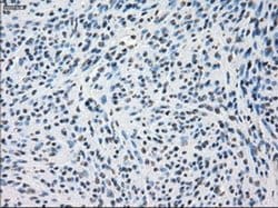 Invitrogen SSX2 Monoclonal Antibody (OTI4A11) 100 &mu;L | Buy Online | Invitrogen&trade; | Fisher Scientific