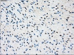 Invitrogen SSX2 Monoclonal Antibody (OTI4A11) 100 &mu;L | Buy Online | Invitrogen&trade; | Fisher Scientific