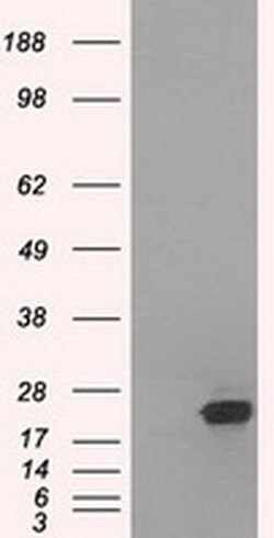 Invitrogen SSX2 Monoclonal Antibody (OTI4A11) 100 &mu;L | Buy Online | Invitrogen&trade; | Fisher Scientific
