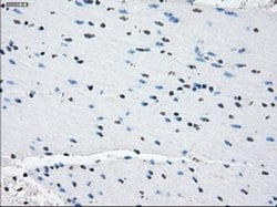 Invitrogen PDE10A Monoclonal Antibody (OTI1C9) 100 &mu;L; Unconjugated:Antibodies,