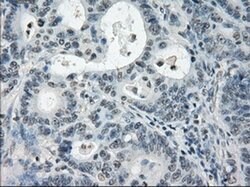 Invitrogen PDE10A Monoclonal Antibody (OTI1C9) 100 &mu;L; Unconjugated:Antibodies,