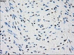 Invitrogen PDE10A Monoclonal Antibody (OTI1C9) 100 &mu;L; Unconjugated:Antibodies,