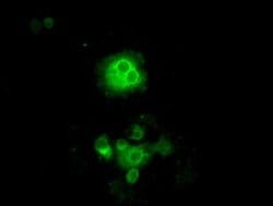 Invitrogen Cytochrome P450 Reductase Monoclonal Antibody (OTI3F10) 100