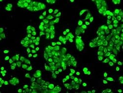 Invitrogen Cytochrome P450 Reductase Monoclonal Antibody (OTI3F10) 100