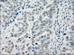 Invitrogen Cytochrome P450 Reductase Monoclonal Antibody (OTI3F10) 100