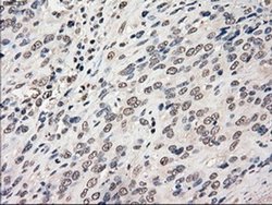 Invitrogen Cytochrome P450 Reductase Monoclonal Antibody (OTI3F10) 100