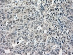 Invitrogen Cytochrome P450 Reductase Monoclonal Antibody (OTI3F10) 100
