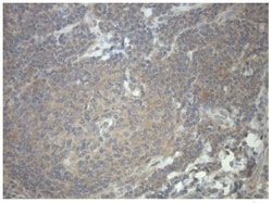 Invitrogen PRKAR1A Monoclonal Antibody (OTI6C7) 100 &mu;L | Buy Online | Invitrogen&trade; | Fisher Scientific