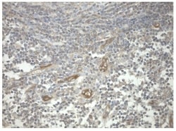 Invitrogen PRKAR1A Monoclonal Antibody (OTI6C7) 100 &mu;L | Buy Online | Invitrogen&trade; | Fisher Scientific