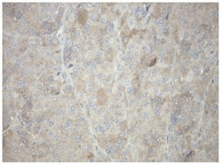 Invitrogen PRKAR1A Monoclonal Antibody (OTI6C7) 100 &mu;L | Buy Online | Invitrogen&trade; | Fisher Scientific