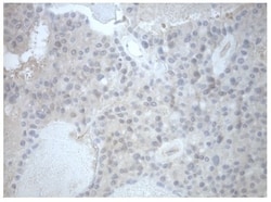 Invitrogen PRKAR1A Monoclonal Antibody (OTI6C7) 100 &mu;L | Buy Online | Invitrogen&trade; | Fisher Scientific