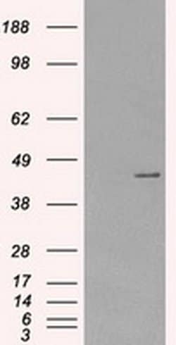Invitrogen PRKAR1A Monoclonal Antibody (OTI6C7) 100 &mu;L | Buy Online | Invitrogen&trade; | Fisher Scientific