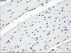 Invitrogen XRCC4 Monoclonal Antibody (OTI4H9) 100 &mu;L; Unconjugated:Antibodies,