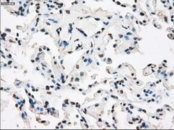 Invitrogen XRCC4 Monoclonal Antibody (OTI4H9) 100 &mu;L; Unconjugated:Antibodies,
