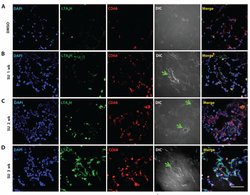 Invitrogen LTA4H Monoclonal Antibody (OTI8F4) 100 &mu;L; Unconjugated:Antibodies,