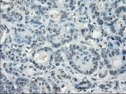 Invitrogen LTA4H Monoclonal Antibody (OTI1E9) 100 &mu;L; Unconjugated:Antibodies,
