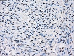 Invitrogen Fumarase Monoclonal Antibody (OTI1F10) 100 &mu;L; Unconjugated:Antibodies,