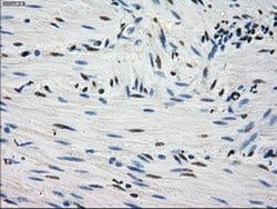 Invitrogen Fumarase Monoclonal Antibody (OTI1F10) 100 &mu;L; Unconjugated:Antibodies,