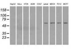 Invitrogen Fumarase Monoclonal Antibody (OTI1F10) 100 &mu;L; Unconjugated:Antibodies,