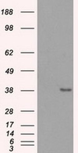 Invitrogen Sorbitol Dehydrogenase Monoclonal Antibody (OTI9E7) 100 &mu;L;