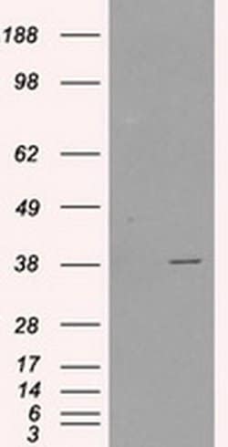 Invitrogen Sorbitol Dehydrogenase Monoclonal Antibody (OTI1D5) 100 &mu;L;