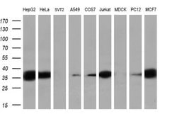 Invitrogen Sorbitol Dehydrogenase Monoclonal Antibody (OTI1D5) 100 &mu;L;