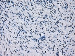 Invitrogen RNF144B Monoclonal Antibody (OTI9H10) 100 &mu;L; Unconjugated:Antibodies,