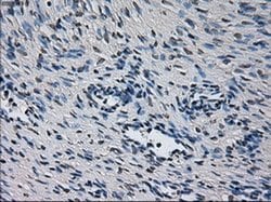 Invitrogen CYP2E1 Monoclonal Antibody (OTI5F11) 100 &mu;L | Buy Online | Invitrogen&trade; | Fisher Scientific
