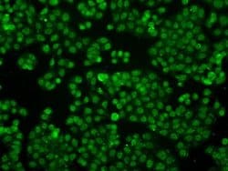 Invitrogen IFIT3 Monoclonal Antibody (OTI1G1) 100 &mu;L; Unconjugated:Antibodies,