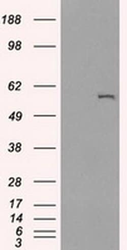 Invitrogen CYP2E1 Monoclonal Antibody (OTI5B9) 100 &mu;L; Unconjugated:Antibodies,