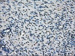 Invitrogen AKR1A1 Monoclonal Antibody (OTI10E11) 100 &mu;L | Buy Online | Invitrogen&trade; | Fisher Scientific