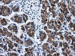 Invitrogen Livin Monoclonal Antibody (OTI1D12) 100 &mu;L; Unconjugated:Antibodies,